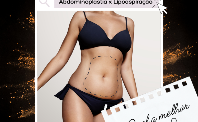  Abdominoplastia x Lipoaspiração