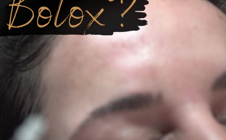  Por que fazer Botox®?