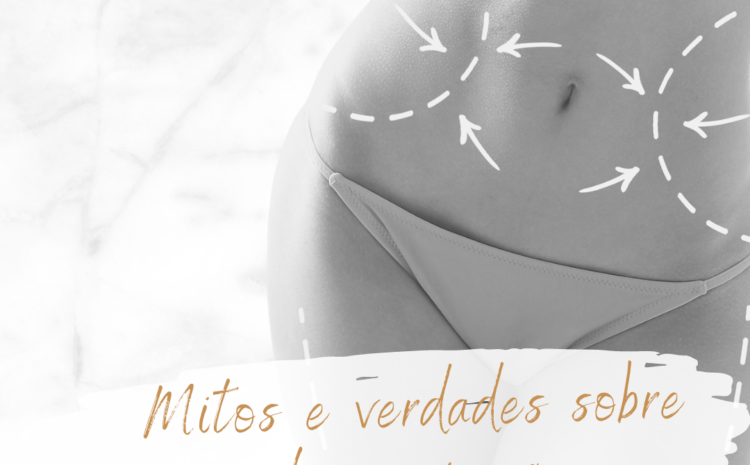  Mitos e verdades sobre a Lipoaspiração