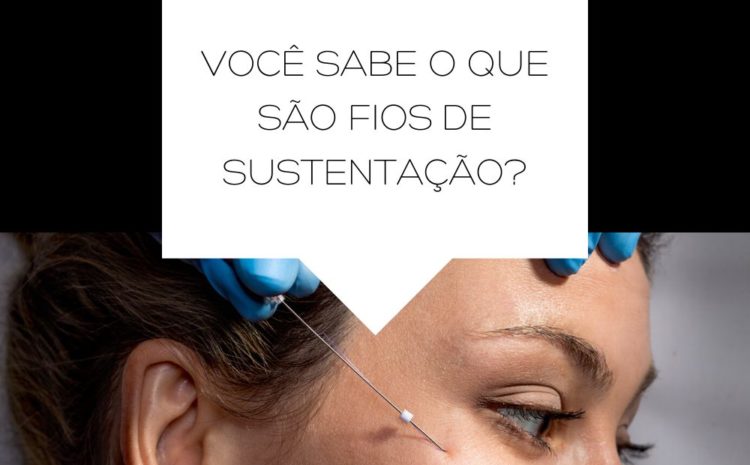  Fios de sustentação