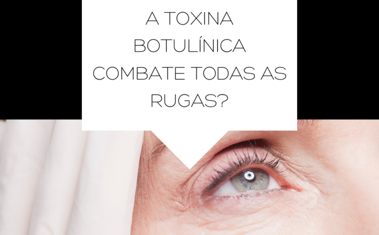  A Toxina Botulínica combate todas as rugas?